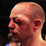 kevin mitchell eye injury