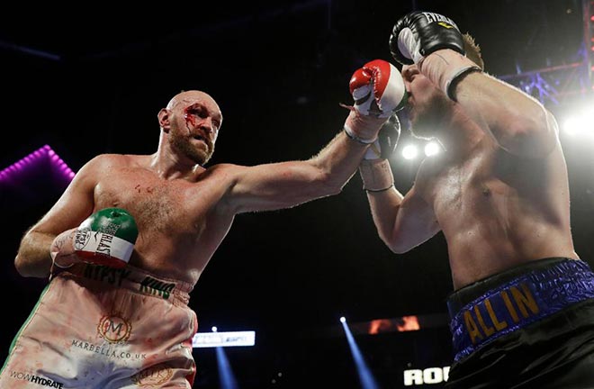 Tyson Fury found himself in deeper waters than expected when facing Otto Wallin. Photo Credit: Forbes.