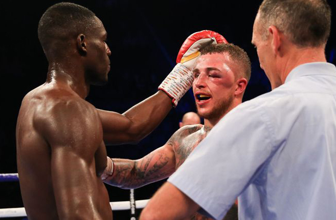 Hyde suffered a horrific eye injury against Richard Riakporhe Credit: Sky Sports