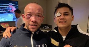 Danny Roman and TJ Doheny showing off their war wounds Credit: MTK Global / Thompson Boxing