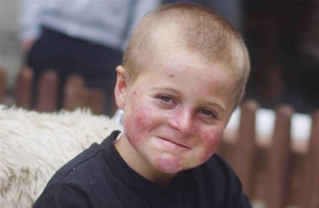 11-year-old Mason White issues a challenge to the Queensberry stable. Photo Credit: UniLad