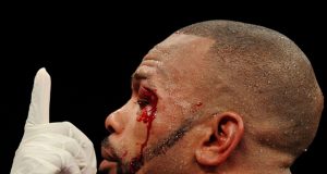 Roy Jones Jr, a shadow of his former self. Photo Credit: Sky Sports.