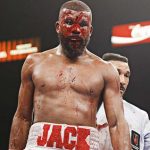 Badou Jack suffered a severe cut during his loss to Marcus Browne. Photo Credit: Esther Lin / Showtime
