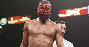 Badou Jack suffered a severe cut during his loss to Marcus Browne. Photo Credit: Esther Lin / Showtime