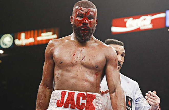 Badou Jack suffered a severe cut during his loss to Marcus Browne. Photo Credit: Esther Lin / Showtime