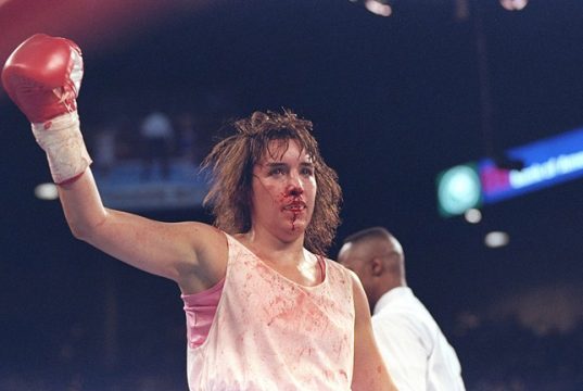 A bloodied and bruised Christy Martin, her defeats won't define her as she has fought her biggest fight outside of the ring. Photo Credit: Sportcasting.