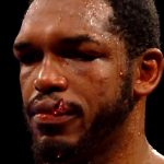 Tureano Johnson suffered one a gruesome cut at the hands of  Jaime Munguia last night.