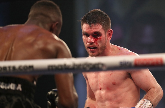 Thomas Patrick Ward suffered a gruesome cut in the seventh round Photo Credit: Mark Robinson/Matchroom Boxing