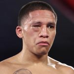 Joshua Franco was unable to continue after suffering an eye injury from what was ruled an Andrew Moloney head clash Photo Credit: Joshua Franco’s eye closed from what the referee and video replay officials deemed a headbutt Photo Credit: Please credit Mikey Williams/Top Rank via Getty Images
