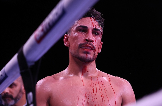 Gill suffered a nasty injury during a technical draw with Castillo.  Photo: Mark Robinson/Matchroom Boxing