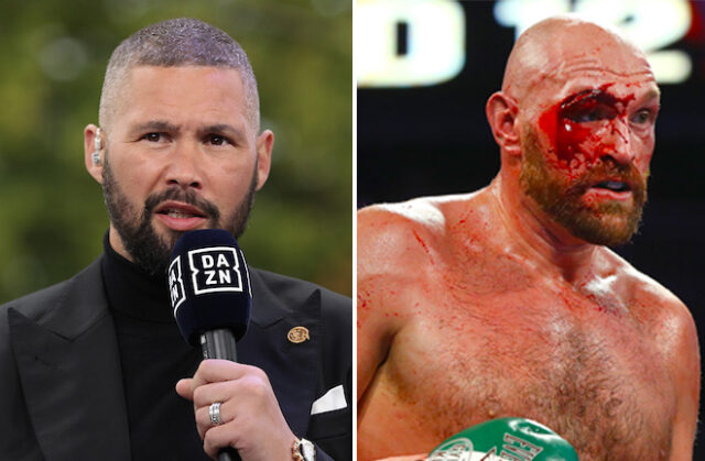 Tony Bellew has slammed those questioning Tyson Fury's cut Photo Credit: Mark Robinson/Matchroom Boxing/Mikey Williams/Top Rank