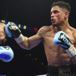 Ortiz suffered a nasty cut during his defeat to Lopez Photo Credit: Mikey Williams/Top Rank