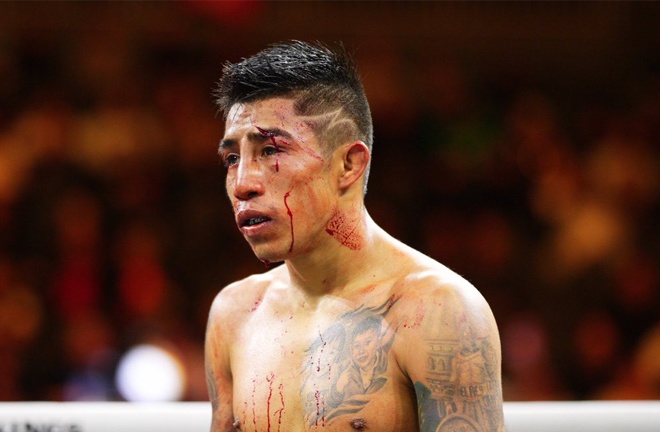 Martinez had a tougher night than expected against Cordoba (PBC)