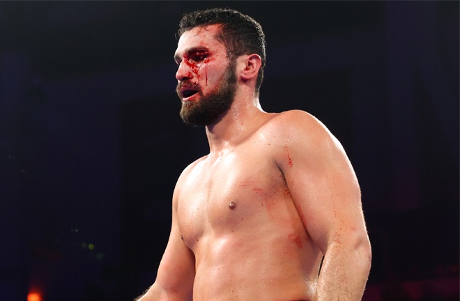 Vianello's sole loss was a bloody affair (Photo Credit: Mikey Williams, Top Rank)