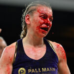 Zimmermann suffered a gruesome cut in her defeat to Harper Photo Credit: GBM Sports
