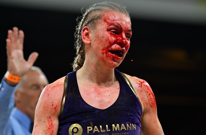 Zimmermann suffered a gruesome cut in her defeat to Harper Photo Credit: GBM Sports