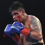 Navarrete suffered a brutal cut Photo Credit: Mikey Williams/Top Rank