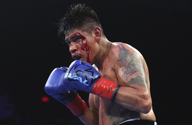 Navarrete suffered a brutal cut photo: Mikey Williams/Top Rank