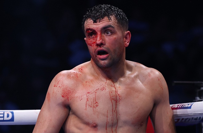Catterall left bloodied after clashing heads with Eubank Photo Credit: Mark Robinson Matchroom Boxing