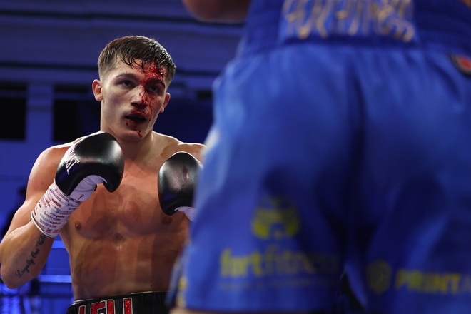 Leli Buttigieg picked up a nasty cut in the second round credit: Mark Robinson Matchroom Boxing.