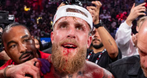 Paul suffered a broken jaw Photo Credit: Esther Lin / Most Valuable Promotions