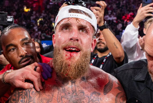 Paul suffered a broken jaw Photo Credit: Esther Lin / Most Valuable Promotions