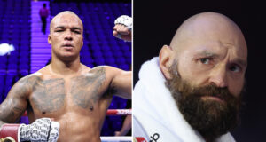 Fabio Wardley believes he's a "banana skin" for Tyson Fury Photo Credit: Leigh Dawney/Queensberry Promotions