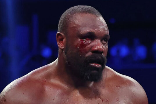 Chisora speaks on his motivations ahead of Wilder fight. Credit: Leigh Dawney/ Queensberry