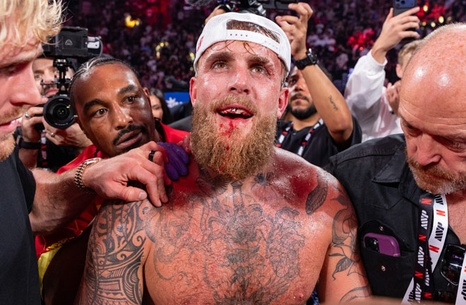 Paul broke his jaw against Joshua Photo Credit: Esther Lin / Most Valuable Promotions